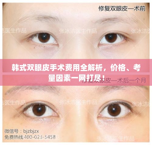 韓式雙眼皮手術(shù)費(fèi)用全解析，價(jià)格、考量因素一網(wǎng)打盡！