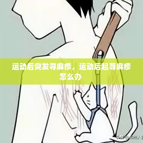 運(yùn)動(dòng)后突發(fā)尋麻疹，運(yùn)動(dòng)后起蕁麻疹怎么辦 