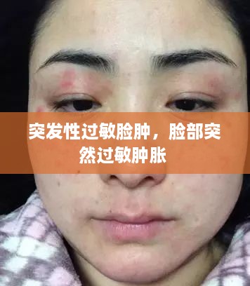 突發(fā)性過敏臉腫，臉部突然過敏腫脹 