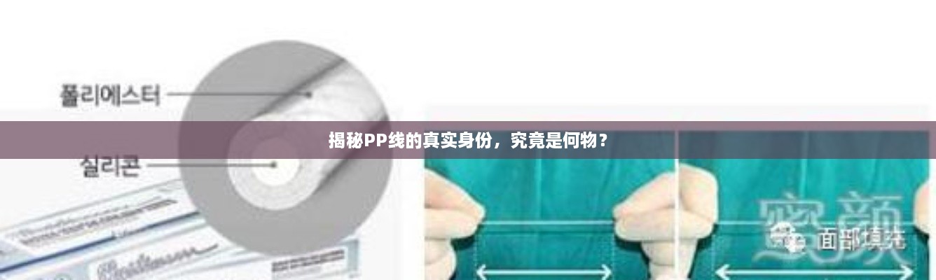 揭秘PP線的真實(shí)身份，究竟是何物？