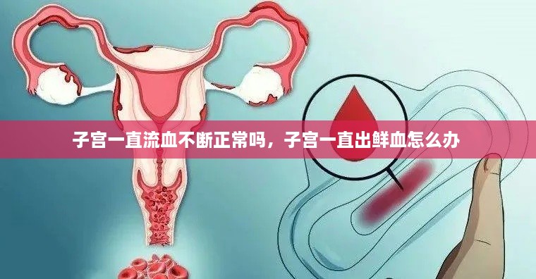 子宮一直流血不斷正常嗎，子宮一直出鮮血怎么辦 