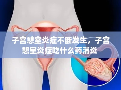子宮憩室炎癥不斷發(fā)生，子宮憩室炎癥吃什么藥消炎 