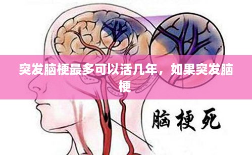 突發(fā)腦梗最多可以活幾年，如果突發(fā)腦梗 