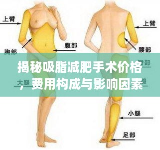 揭秘吸脂減肥手術(shù)價(jià)格，費(fèi)用構(gòu)成與影響因素全解析